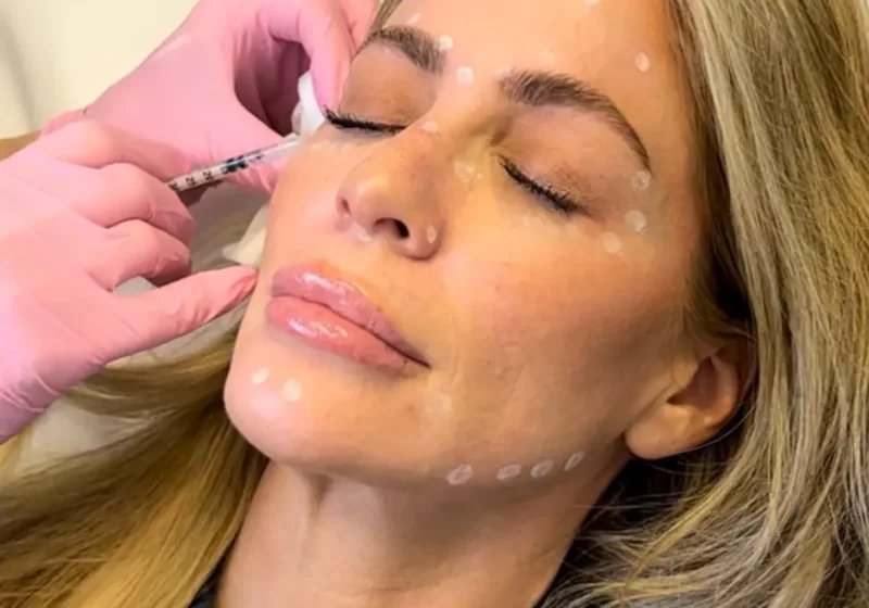 botox in BioSpa Training Center